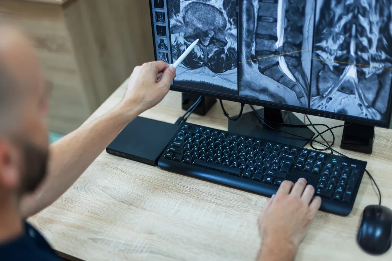 Spine specialist evaluating a lumbar spine MRI